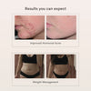 PCOS Hormone Balance